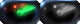 Frostbite